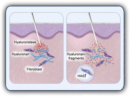 Diagram showing hyaluronidase breaking down hyaluronan in tissue