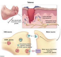Diagram of tetanus toxin action in neurons