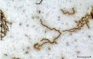 Diagram of endoflagella in spirochetes