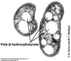 Electron micrograph of poly-β-hydroxybutyrate granules in bacteria
