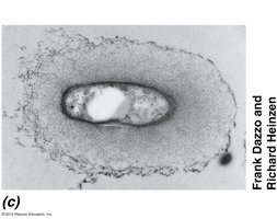 Electron micrograph showing a bacterial capsule