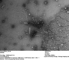 TEM image of bacteriophage