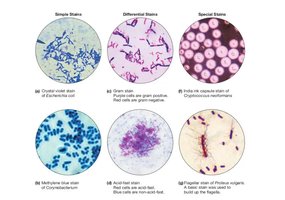 Examples of simple, differential, and special stains