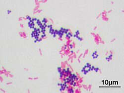 Gram stain of mixed S. aureus and E. coli