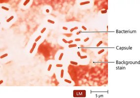Negative stain of Klebsiella pneumoniae