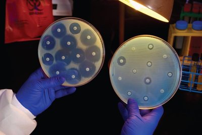 Kirby-Bauer disc diffusion test showing zones of inhibition