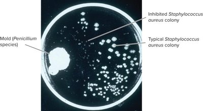Discovery of penicillin: Penicillium mold inhibiting Staphylococcus aureus colonies