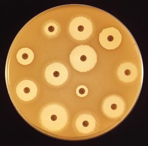Close-up of Kirby-Bauer disc diffusion test plate