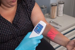 AccuVein system projecting veins