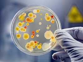 Petri dish with mixed bacterial colonies