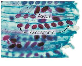 Ascospores from cup fungus