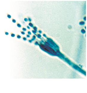 Conidiospores from Penicillium