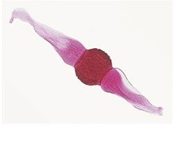 Zygospore from Rhizopus