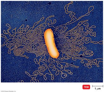 TEM image of prokaryotic chromosome
