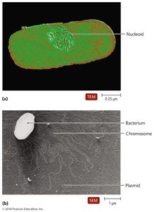 TEM and SEM images of nucleoid and plasmid