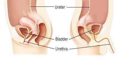 Diagram showing lower and upper urinary tract