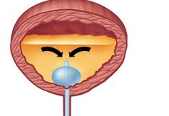 Bladder with catheter and urine flow