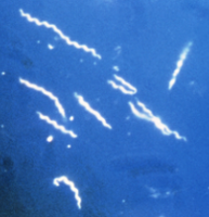 Spirochete bacteria under microscope