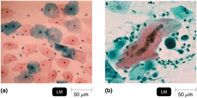 Cytopathic effects in cell culture