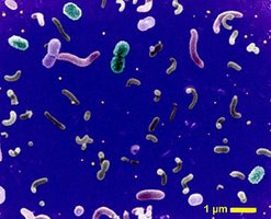 Various bacteria under a microscope