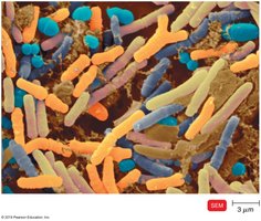 Diverse bacteria in the human microbiome