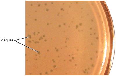 Viral plaques formed by bacteriophages