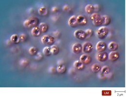 Sulfur deposits in purple sulfur bacteria