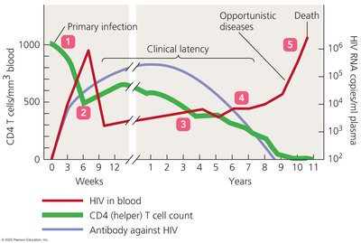 Course of AIDS and helper T cell destruction