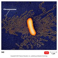 Transmission electron micrograph of E. coli chromosome