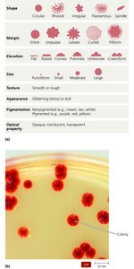 Colony morphology: shapes, margins, elevations, and appearance