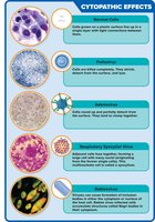 Cytopathic effects of viral infection
