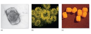 Micrographs of viruses showing structural diversity