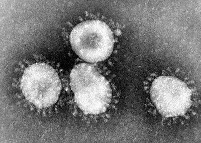 Coronavirus TEM image