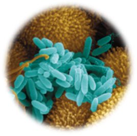 Microscopic image of Pseudomonas aeruginosa