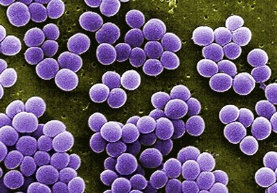 Microscopic image of Staphylococcus aureus clusters