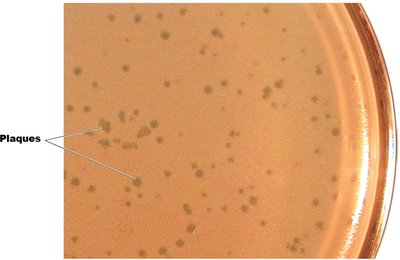 Viral plaques formed by bacteriophages