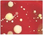Discrete bacterial colonies on agar plate