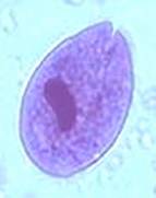 Balantidium coli trophozoite