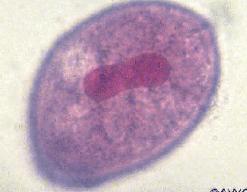 Balantidium coli cyst