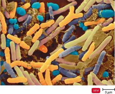 Colorized scanning electron micrograph of diverse bacteria