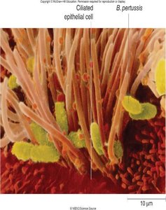 Bordetella pertussis attached to ciliated epithelial cells