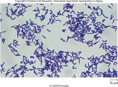 Gram-stained Corynebacterium diphtheriae under microscope