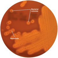 Blood agar, a differential medium