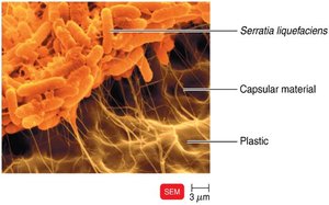 Biofilm on a piece of plastic