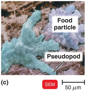 Protozoa with pseudopod, SEM micrograph