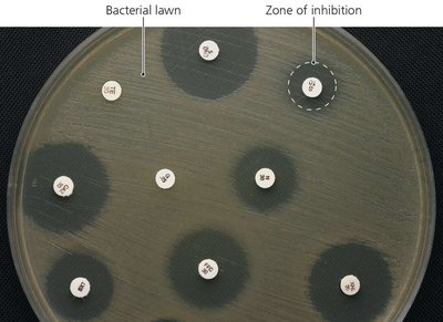 Kirby-Bauer diffusion susceptibility test