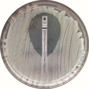 Etest for antimicrobial susceptibility