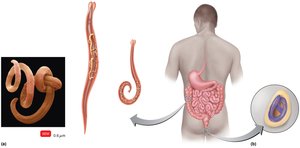 Pinworm anatomy and life cycle