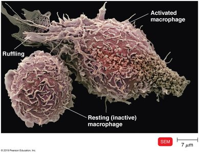Dendritic cell with phagocytosed material
