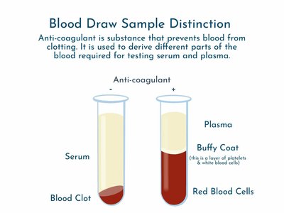 Blood draw sample distinction: serum vs plasma